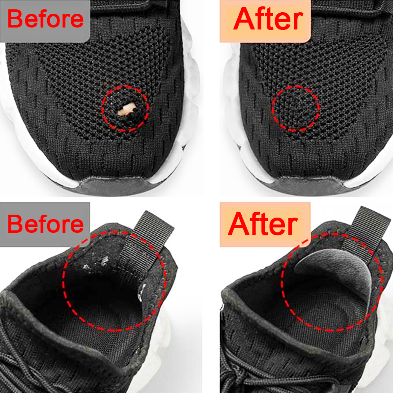 Patch per Scarpe Sportive, Rip - Sneaker Shoe Care Kit recensione e prezzo